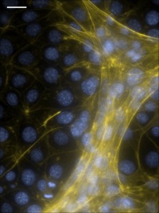 Coculture of epithelial cells and fibroblasts in a mammary gland-mimetic organoid.